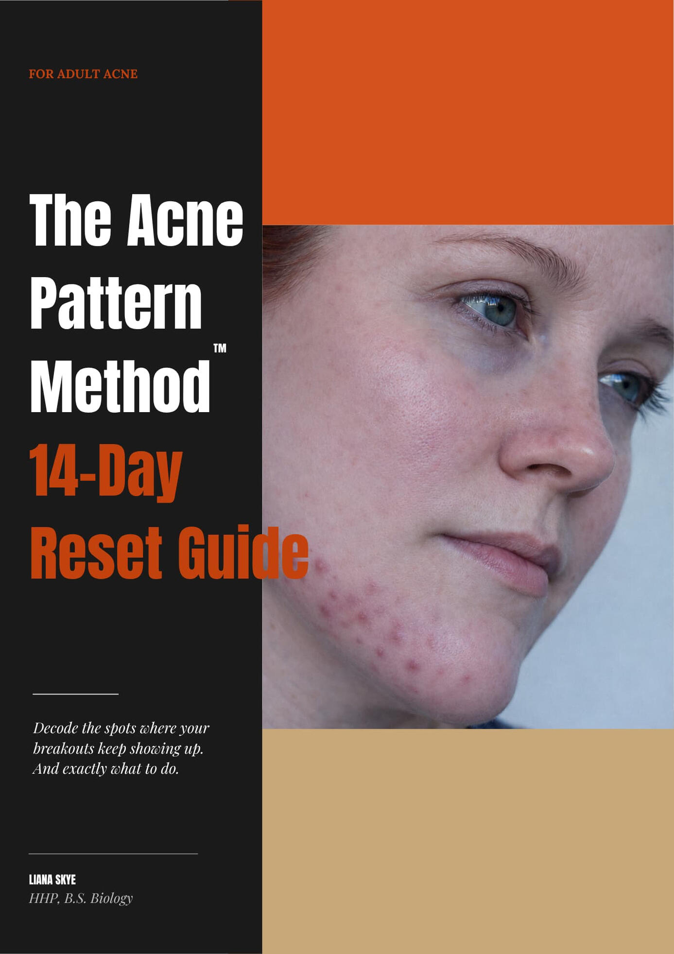 The Acne Pattern Method ebook cover a 47-page 14-day reset for adult women with persistent acne, identifying the 5 acne zones and root causes by Liana Skye, HHP, B.S. Biology